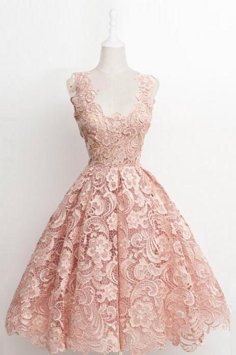 Short Lace Prom Dress, A Line Scalloped Edge Black Lace Dress, Pink Short Homecoming Dress